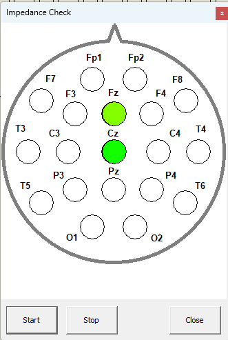 Impedance bad